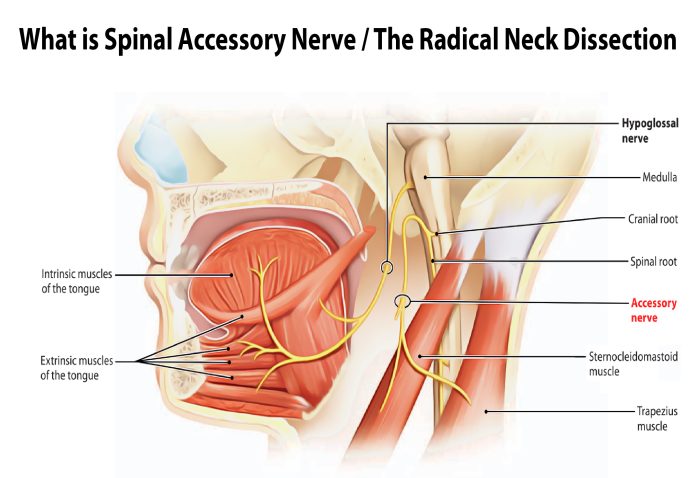 What is Spinal Accessory Nerve / The Radical Neck Dissection